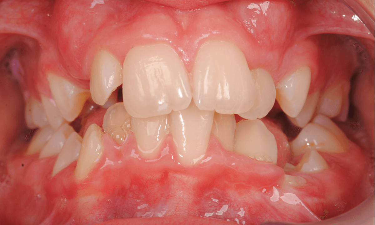 Orthodontie Nieuw-Vennep - Home - 25/10/2025 Orthodontie Nieuw-Vennep - Home - 25/10/2025