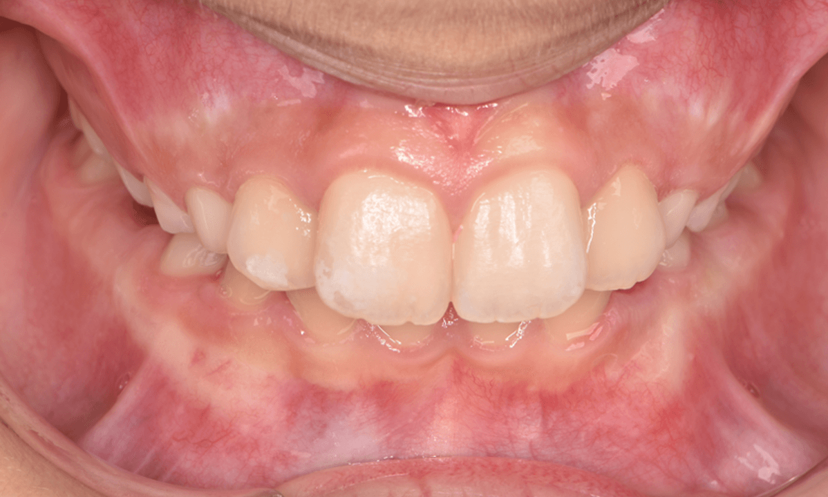 Orthodontie Nieuw-Vennep - Home - 25/10/2025 Orthodontie Nieuw-Vennep - Home - 25/10/2025