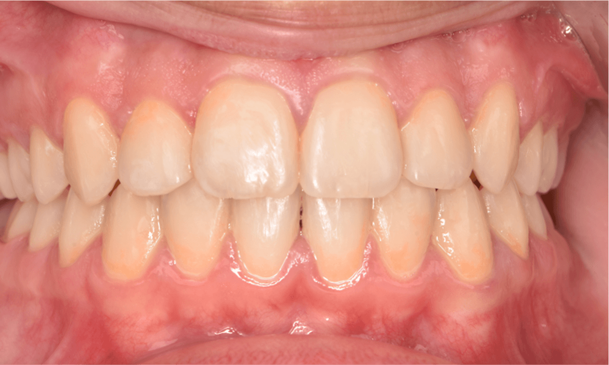Orthodontie Nieuw-Vennep - Home - 25/10/2025 Orthodontie Nieuw-Vennep - Home - 25/10/2025