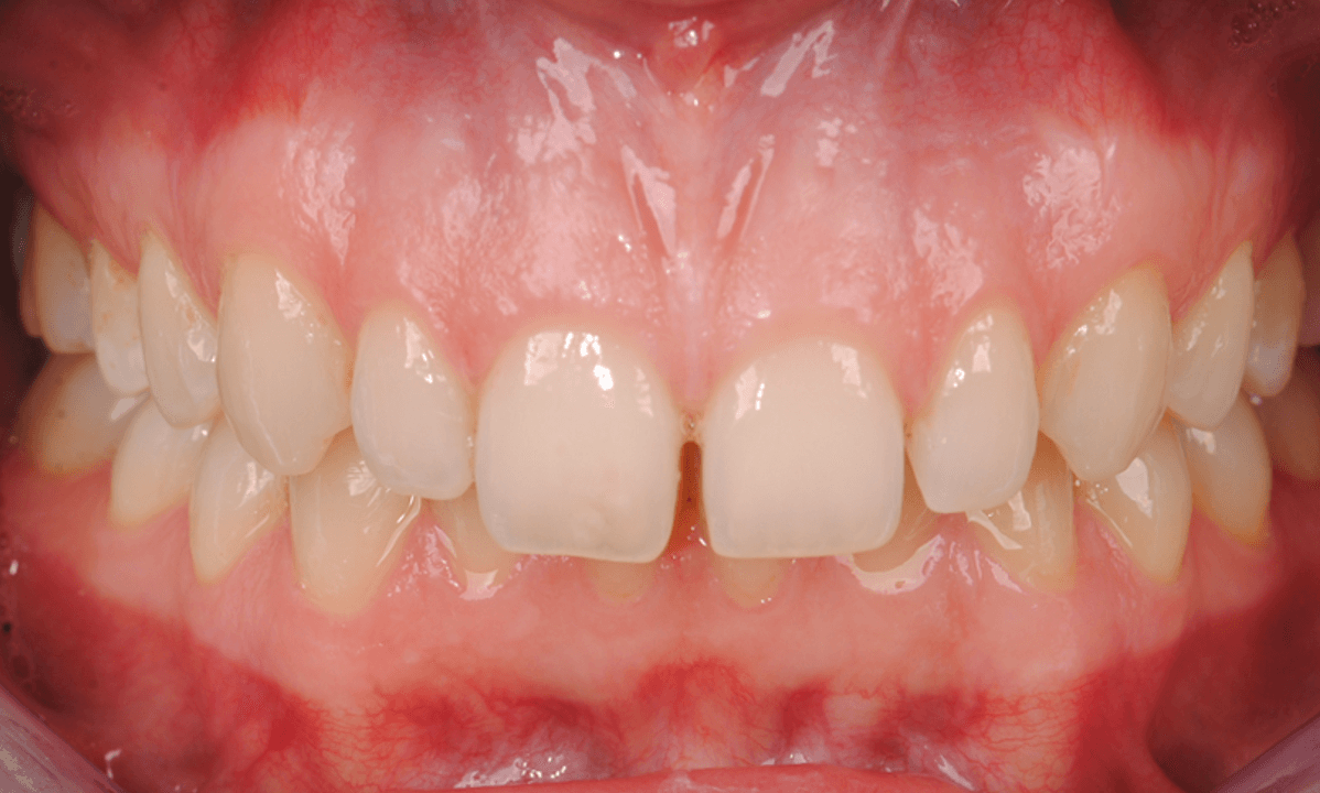 Orthodontie Nieuw-Vennep - Home - 25/10/2025 Orthodontie Nieuw-Vennep - Home - 25/10/2025