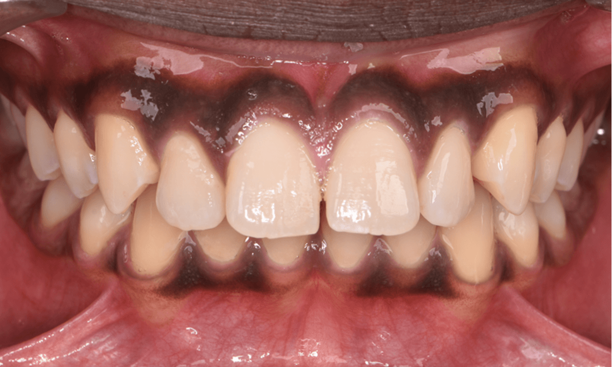 Orthodontie Nieuw-Vennep - Home - 25/10/2025 Orthodontie Nieuw-Vennep - Home - 25/10/2025